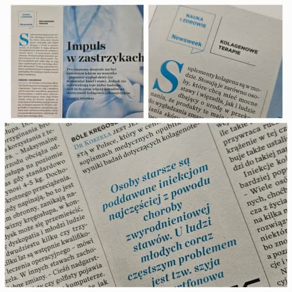 Kolagenoterapia iniekcyjna – nowoczesne narzędzie terapeutyczne. 2 newsweek